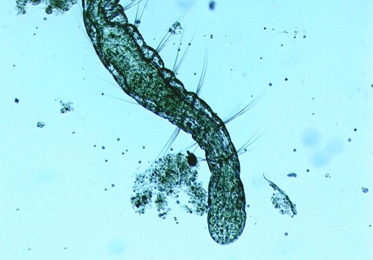 【写真・動画付き】これを読めば大体いける！水槽内に発生した微生物の観察に知っておきたい話について | あんきもブログ